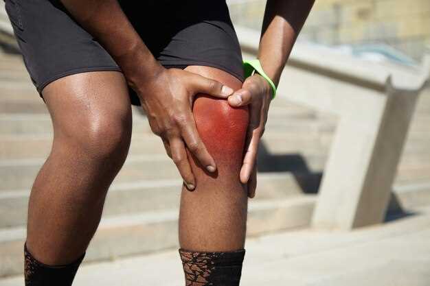 Что такое гонартроз коленного сустава?