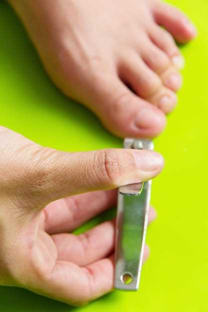 Как предотвратить отслойку ногтей?
