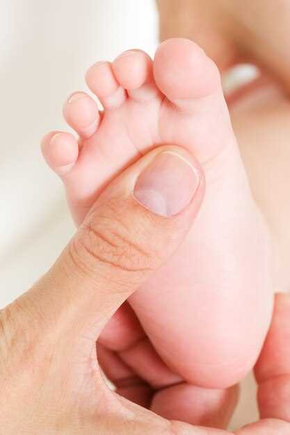 5 эффективных методов лечения грибка на ногтях
