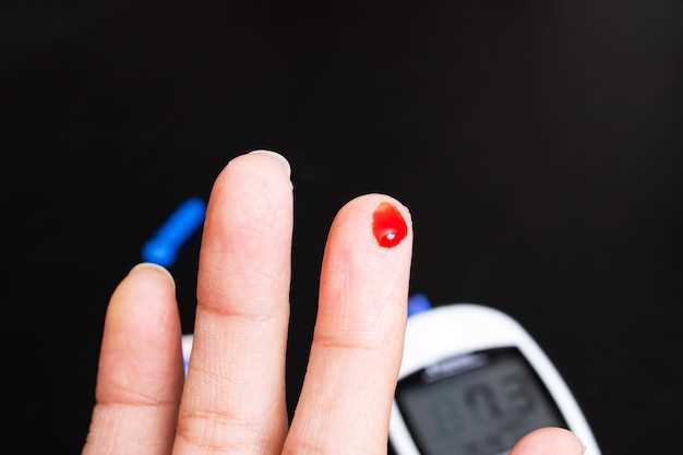Внешние факторы, влияющие на уровень сахара в крови: питание, физическая активность, стресс