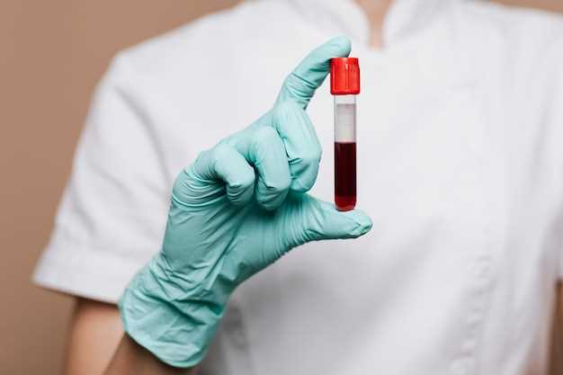 Значение показателей клинического анализа крови для диагностики заболеваний